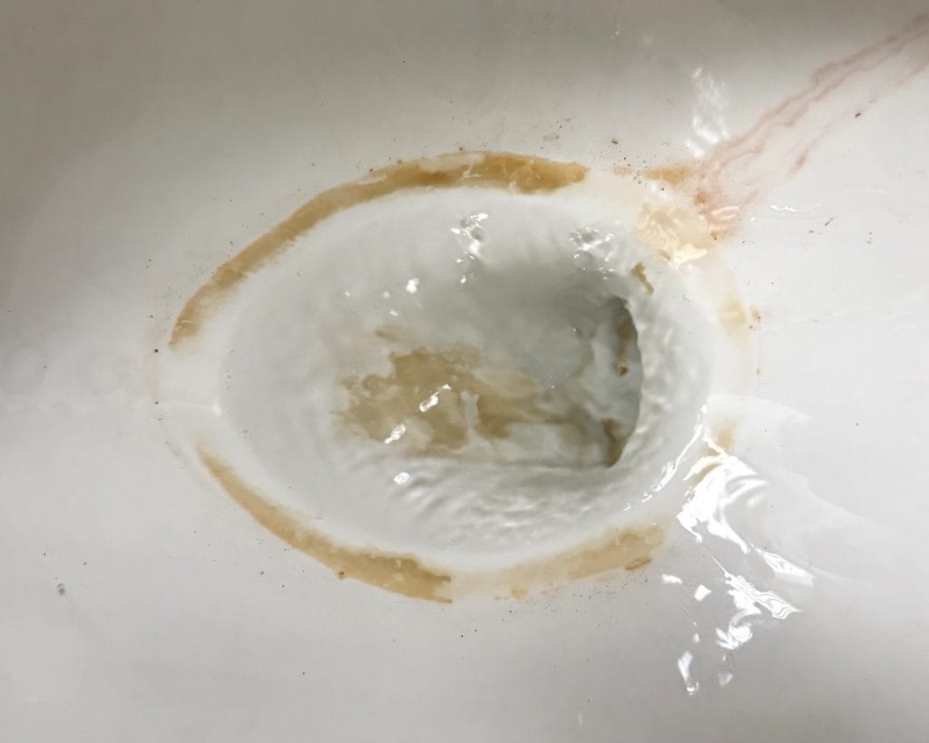 Overhead view of mold or fungi in a toilet bowl, before cleaning.